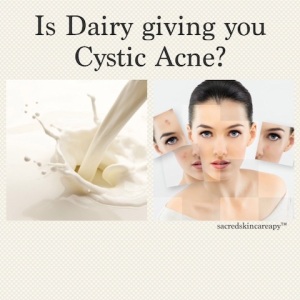 acne_dairy